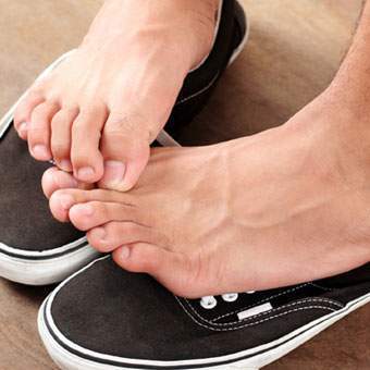 Natural Remedies for Athlete's Foot